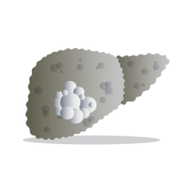 hepatite c